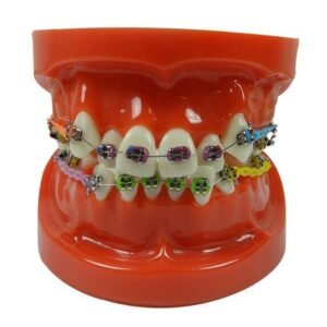 LD Study Model Ortho with Mini Implant - LD-087