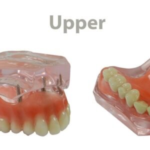 LD Study Model Overdenture with 4 Implants - Upper - LD-094