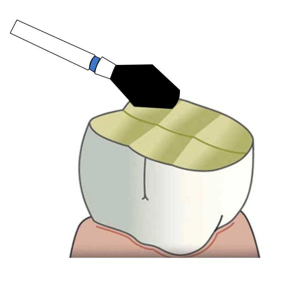 Frank Dental Barrel Shaped FG Diamond Burs EX - Series