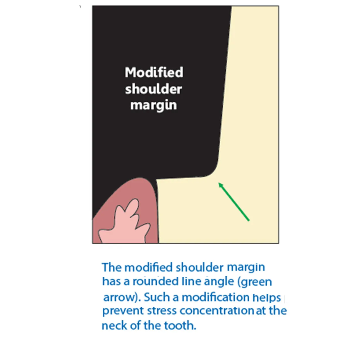 Frank Dental Cylinder Round Edge Diamond Bur SRS Series (Regular)