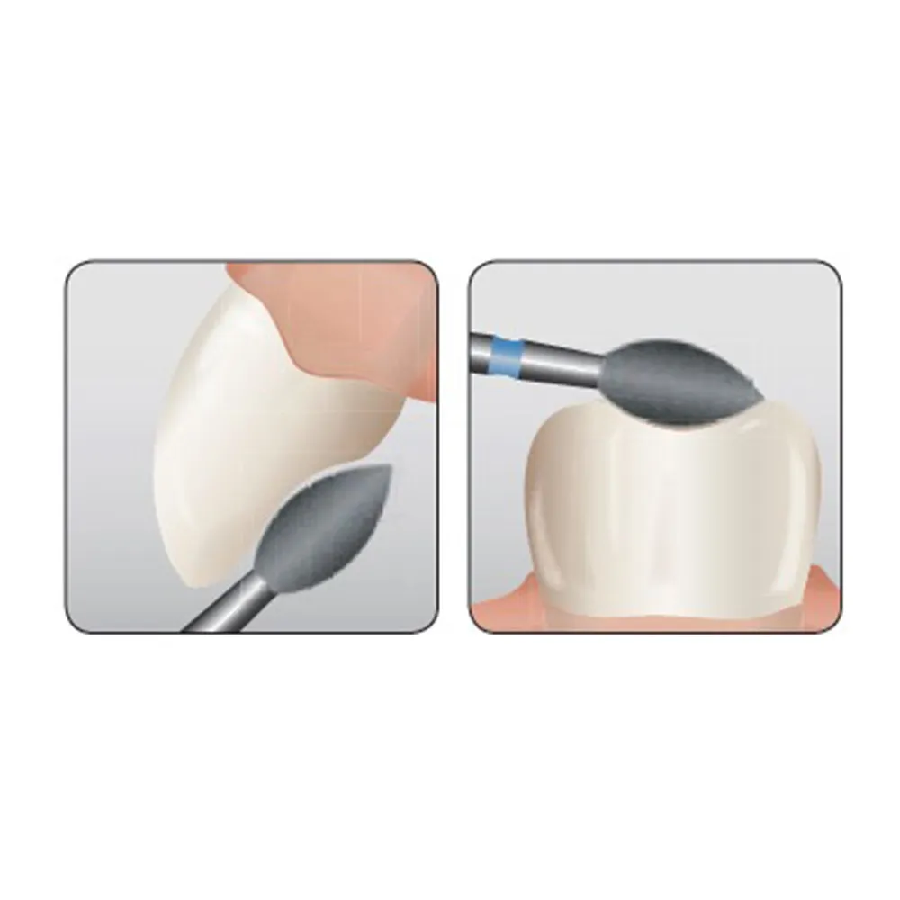 Frank Dental Flame Ogival Diamond Bur FG - FO (Made in Germany)