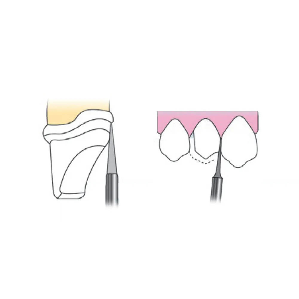 Frank Dental Tapered Cone Diamond Bur FG -TC (Made in Germany)