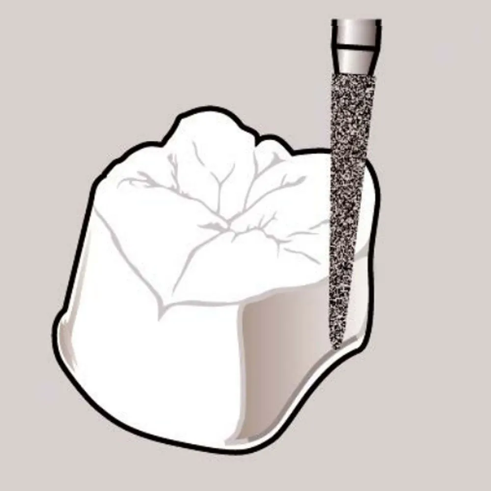 Frank Dental Tapered Cone FG Diamond Burs TC Series ( Super Coarse)