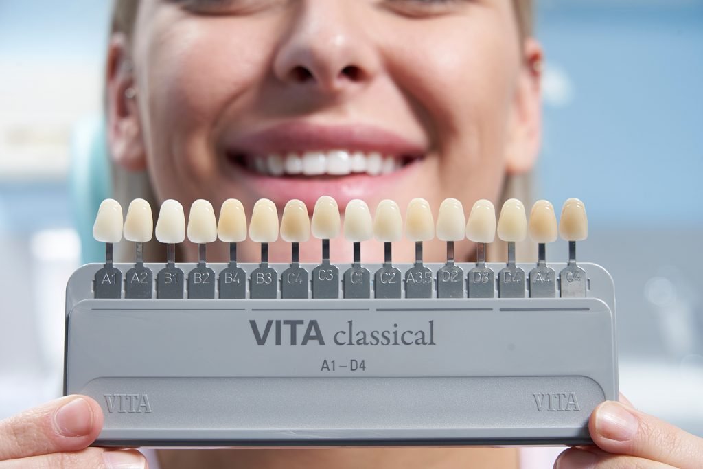 vita shade guide classical vita shade guide classical