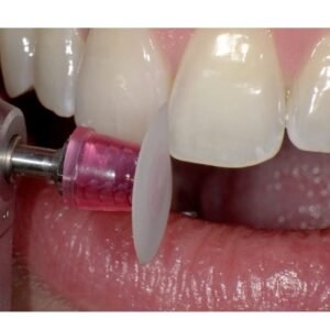 Shofu Super Snap X-Treme Kit 1