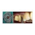 Advanced Biotech Periodontal Plus Ab