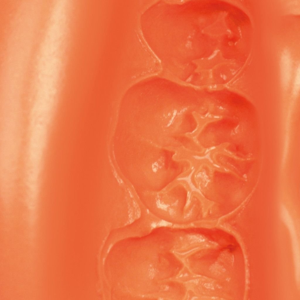 Zhermack Neocolloid Alginate Powder 4 Zhermack Neocolloid Alginate Powder 4