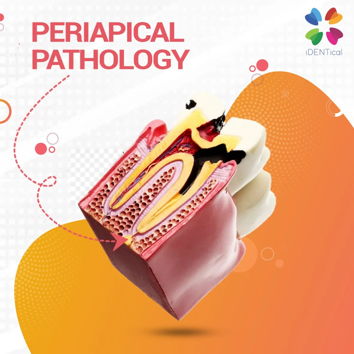 caries_vs_healthy_teeth-7 caries_vs_healthy_teeth-7