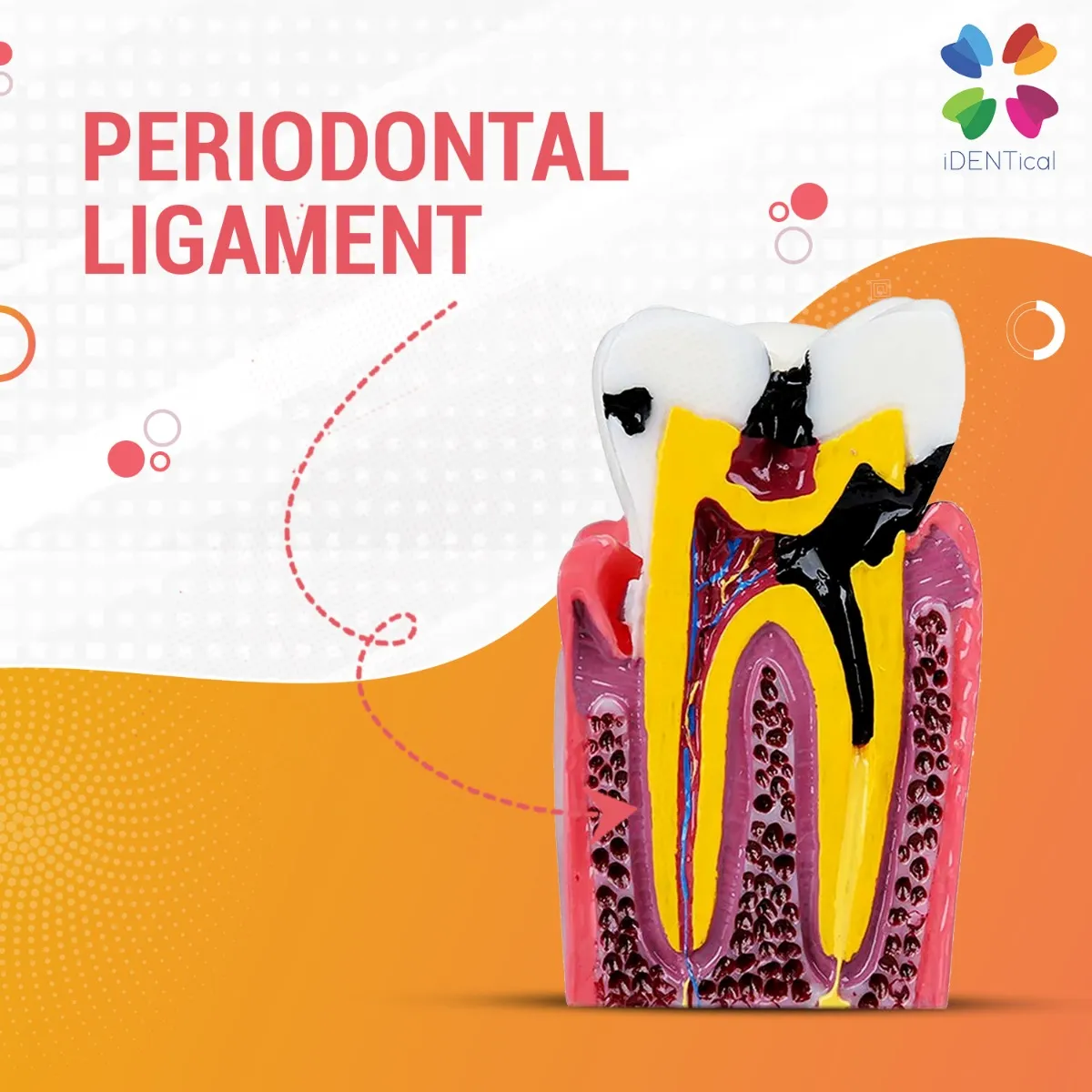 caries_vs_healthy_teeth-7_copy caries_vs_healthy_teeth-7_copy