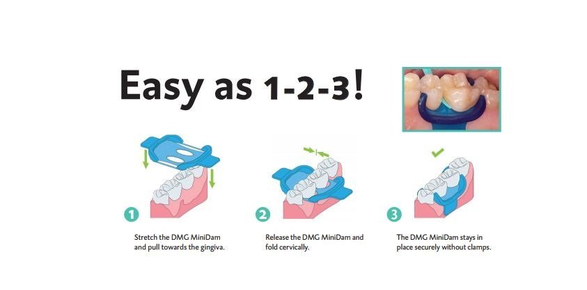 dmg-minidam_2 dmg-minidam_2