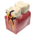 identical-caries-healthy-teeth-model-m4021
