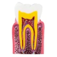 identical-caries-healthy-teeth-model-m4021-c
