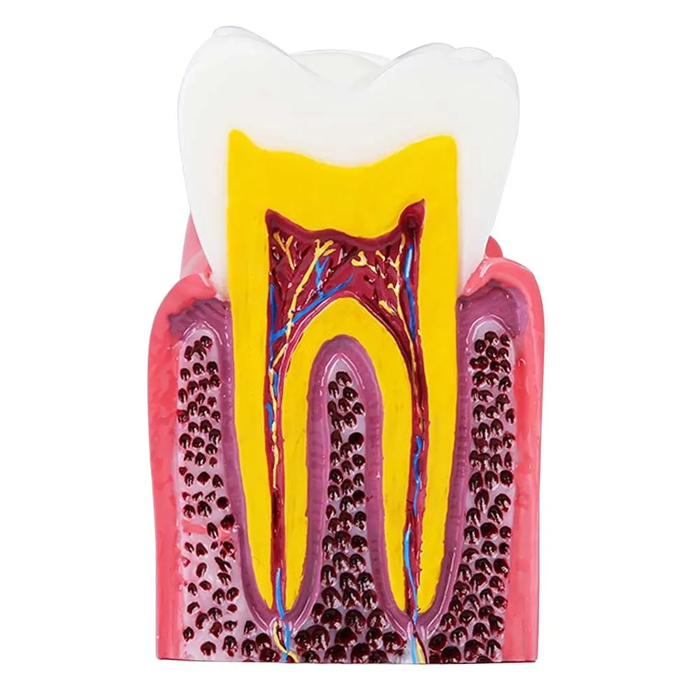 identical-caries-healthy-teeth-model-m4021-c identical-caries-healthy-teeth-model-m4021-c