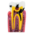 identical-caries-healthy-teeth-model-m4021-d
