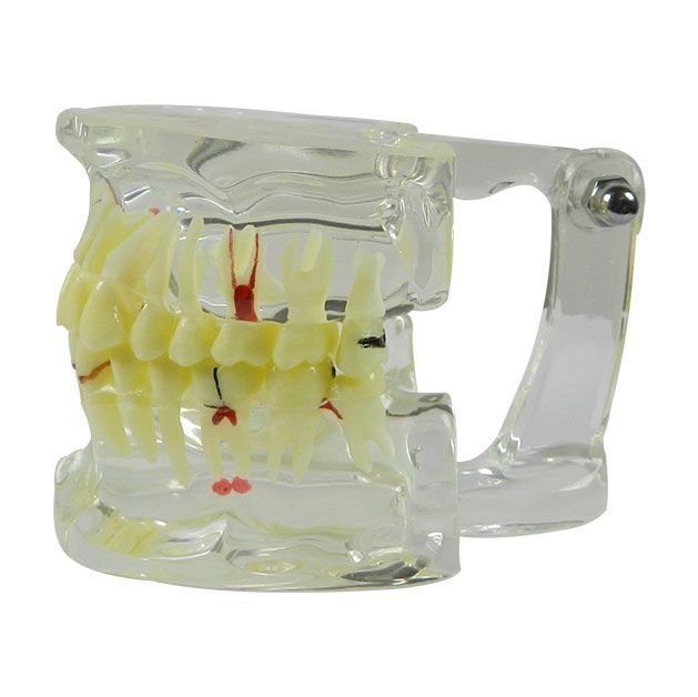 iDENTical Adult Pathologies Model M4001-2