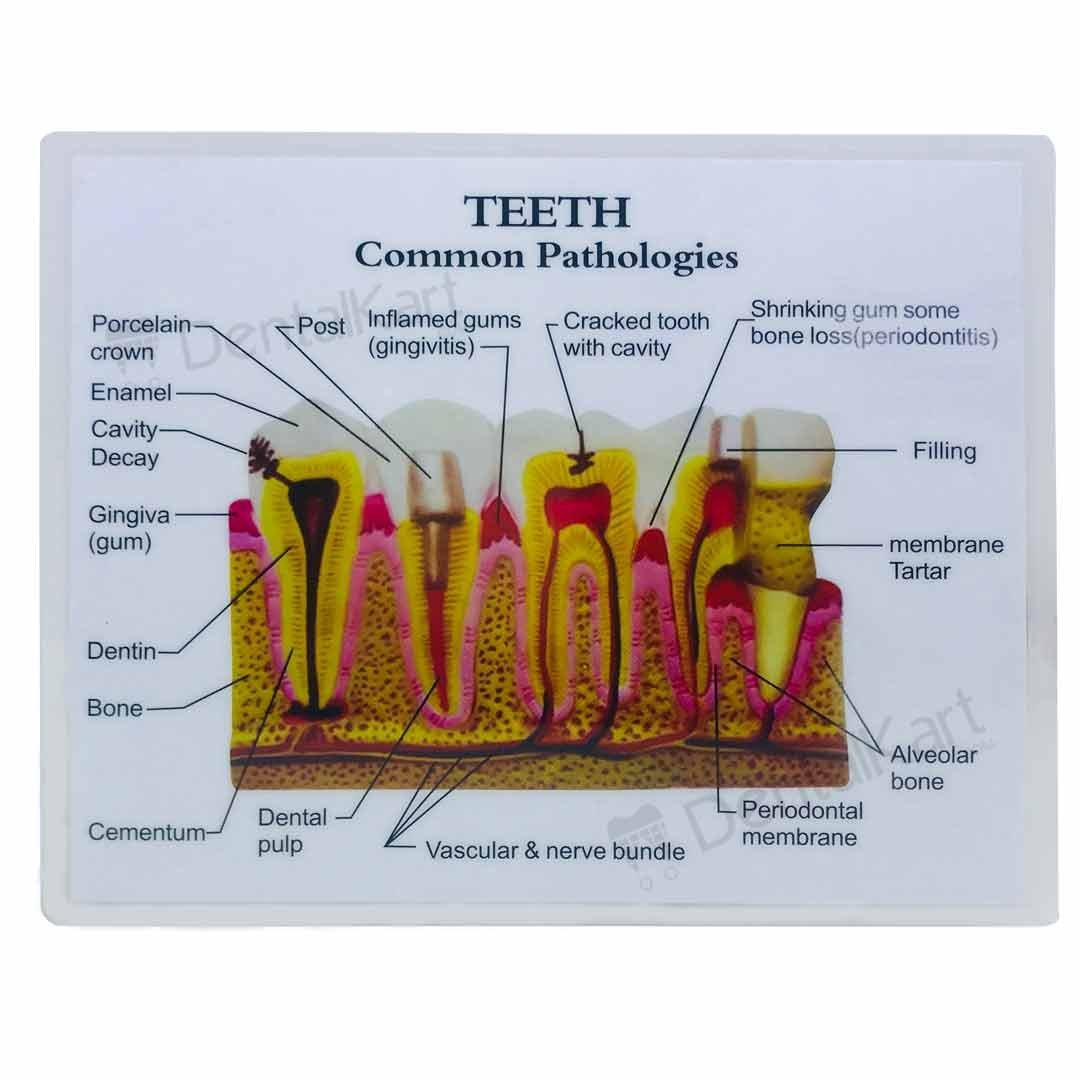 iDENTical Diseased Teeth and Gums Model M4029 iDENTical Diseased Teeth and Gums Model M4029