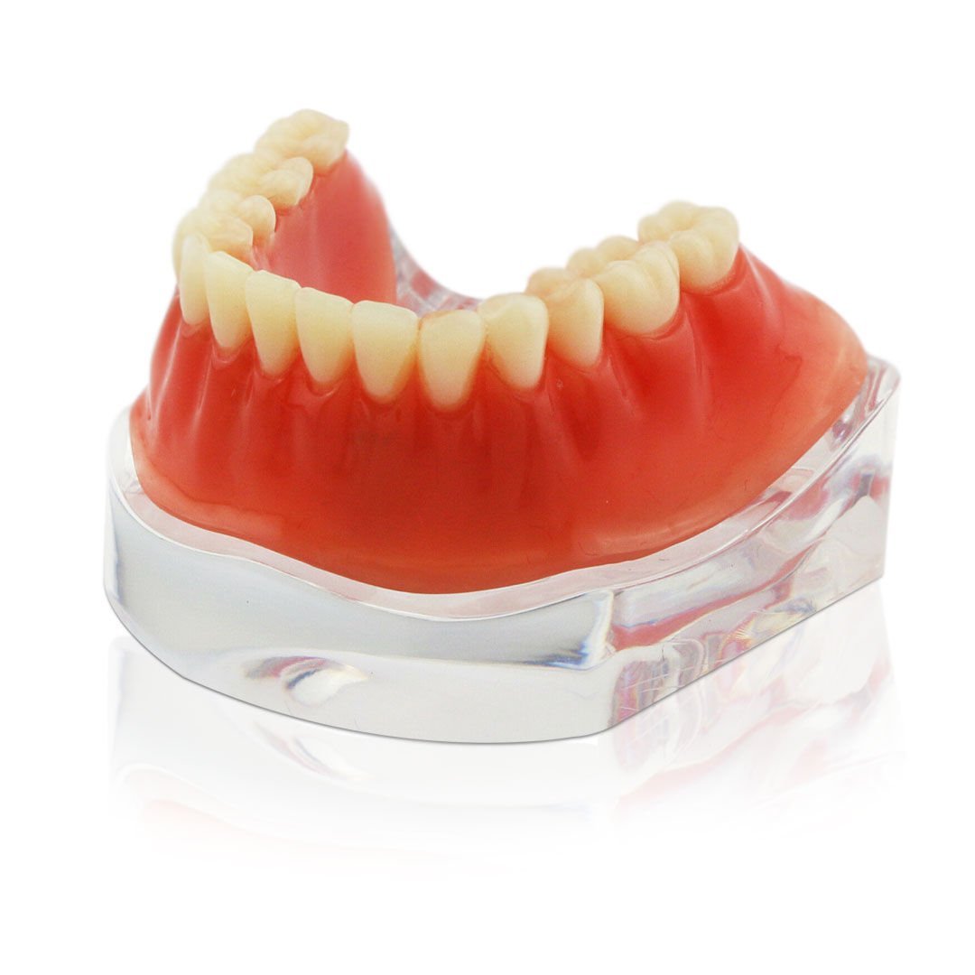 iDENTical Implant Model With Silver Bar M6008