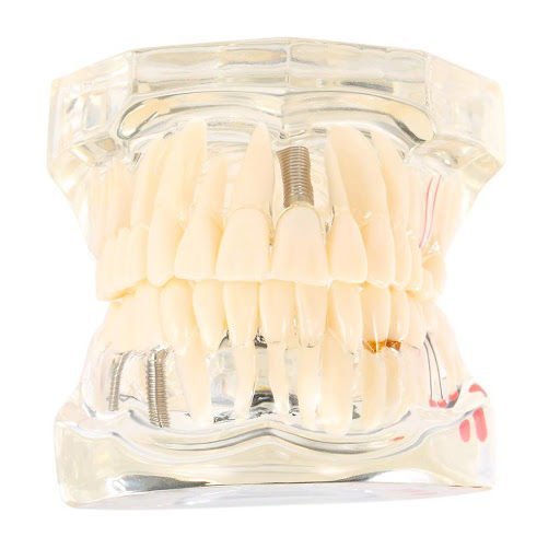 iDENTical All In One Dental Implant Model M2001 - White