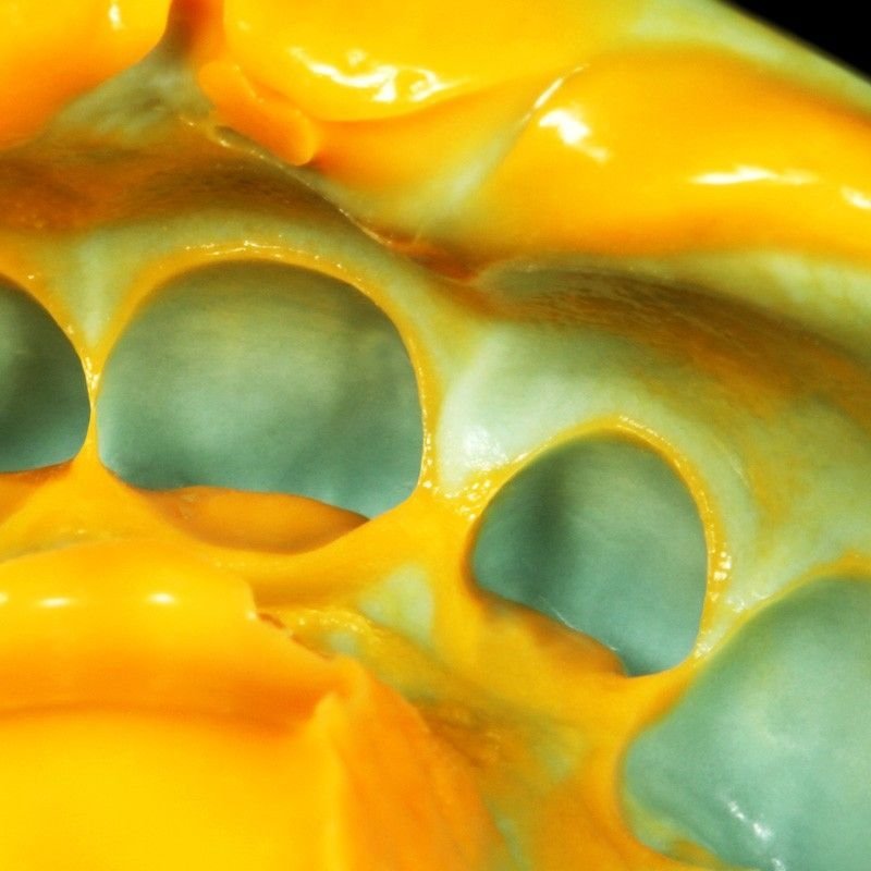 zetaplus 2 zetaplus 2